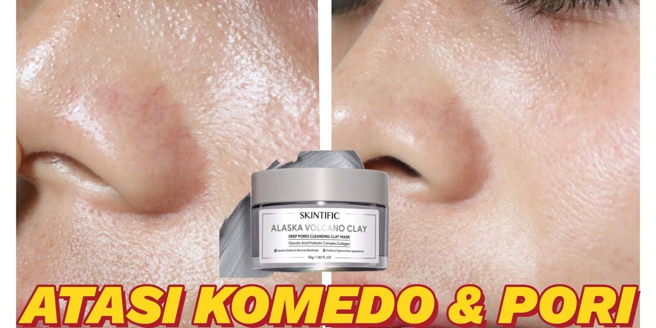 Review Skintific Alasaka Volcano Yang Sedang Banting Harga