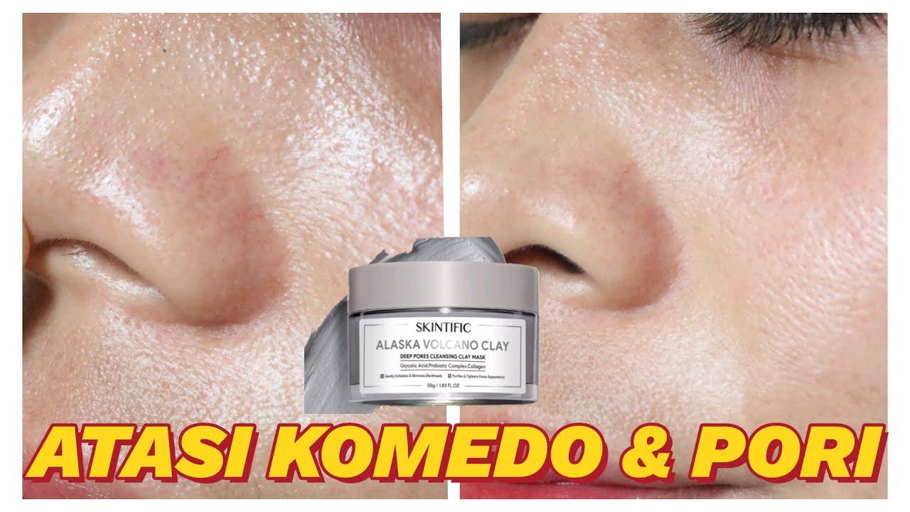 Review Skintific